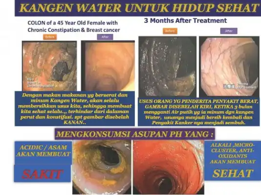 reaksi positif pasca konsumsi kangen water